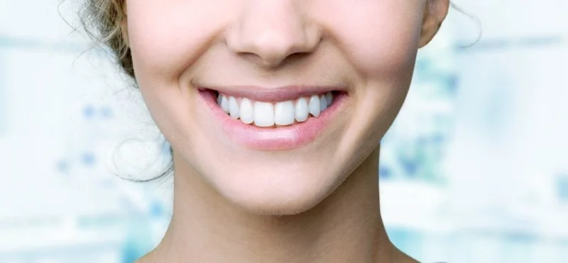 - - White Teeth